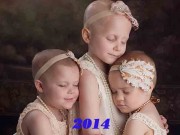 Làm mẹ - 3 bé gái mắc ung thư từng gây xúc động dư luận năm 2014 giờ xinh đẹp hơn rất nhiều