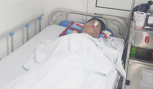 Diễn viên xiếc bị cắn nát mặt vì thò đầu vào miệng cá sấu hiện giờ ra sao? - 1