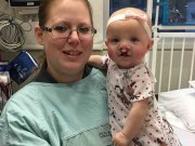 Làm mẹ - Hình ảnh xinh đẹp khác lạ, nụ cười tròn trịa sau phẫu thuật của bé gái bị hở hàm ếch