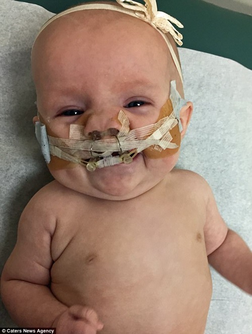 Hình ảnh xinh đẹp khác lạ, nụ cười tròn trịa của bé gái sau ...