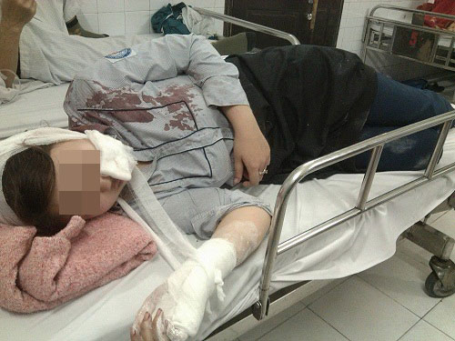 Hé lộ nguyên nhân ban đầu vụ nữ sinh bị đánh hội đồng bằng tuýp sắt - 1