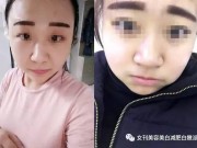 Làm đẹp - Lao đi mua dụng cụ làm đẹp tiện ích, chị em nhận cái kết không thể đắng hơn