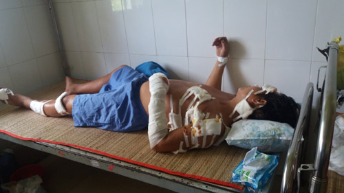 Nghi có bồ, chồng trẻ bị vợ già chém gần 20 nhát - 1