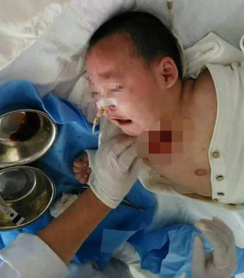 Quấy khóc khi mẹ và nhân tình đang amp;#34;mây mưaamp;#34;, bé gái 1 tuổi bị đánh đến hôn mê - 2