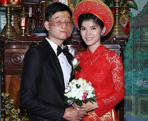 3 cặp đôi yêu nhau bất chấp ngoại hình khiến dân mạng dậy sóng - 6
