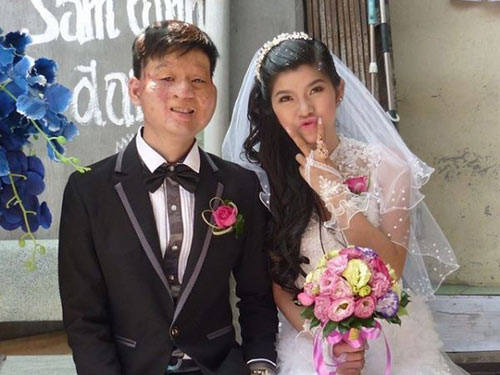 3 cặp đôi yêu nhau bất chấp ngoại hình khiến dân mạng dậy sóng - 7