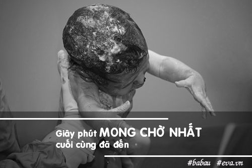 20 bức ảnh kể lại trọn vẹn, chân thực quá trình amp;#34;mang nặng đẻ đauamp;#34; - 17