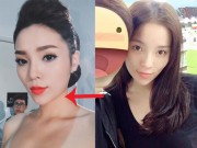 Làm đẹp - Dấu chấm hỏi cho chiếc cằm dài và nhọn khó hiểu của Kỳ Duyên