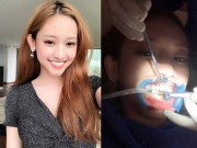 Làm đẹp - Bạo tay chi 250 triệu làm lại 19 chiếc răng, Thúy Vi gây xôn xao