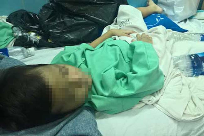 Bé trai 10 tuổi bị mẹ đẻ và bố dượng bạo hành, đánh gãy xương đùi - 1