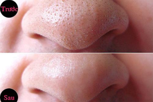 Top 10 chủ đề làm đẹp được chị em phụ nữ quan tâm nhất 2017 vừa qua - 13