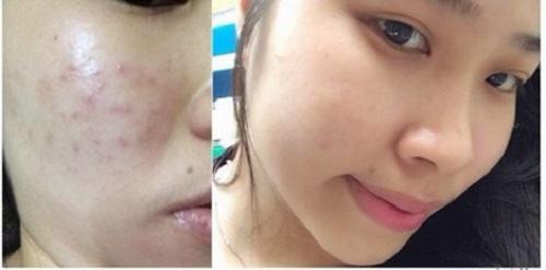 Top 10 chủ đề làm đẹp được chị em phụ nữ quan tâm nhất 2017 vừa qua - 14