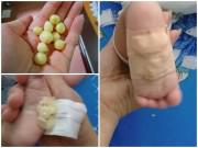 Nuôi con - Mẹ bỉm sữa đua nhau dùng hành tăm dán lòng bàn chân giúp trị ho, sổ mũi cho trẻ