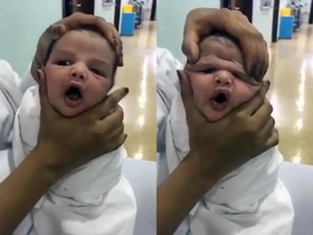 Nữ y tá vừa cười khúc khích vừa ấn đầu, bóp má trẻ sơ sinh đến biến dạng