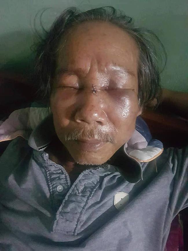 Bảo vệ chung cư  đánh đập ông lão 68 tuổi gãy sống mũi vì... đỗ xe không đúng chỗ - 2