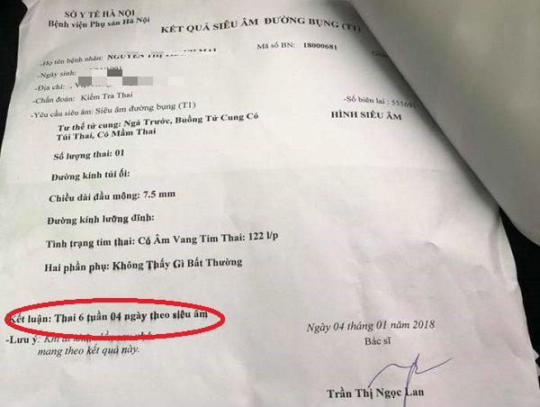 Hà Nội: Bác sĩ khẳng định thai chết lưu cho đi hút, sang viện khác khám thai vẫn bình thường - 4