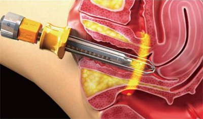 Sợ “gần” chồng - nỗi lòng khó nói của chị em sau sinh - 2