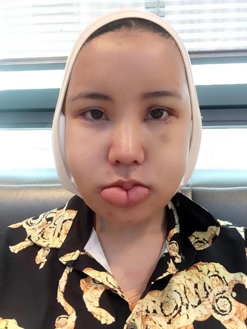 ton gan 100 trieu di qua han got cam va cai ket bat ngo khong tin vao mat! - 10