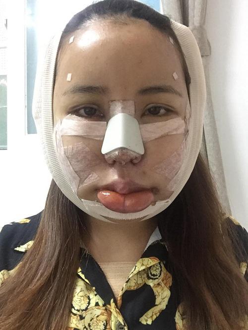 ton gan 100 trieu di qua han got cam va cai ket bat ngo khong tin vao mat! - 8