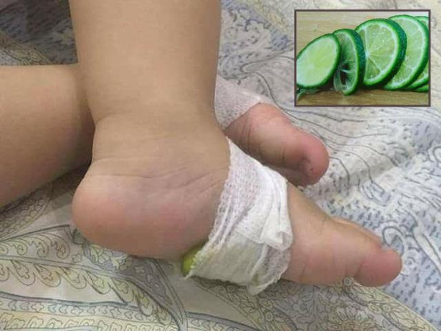 Mẹ Hà Nội mách mẹo dùng chanh cắt lát hạ sốt cho trẻ tức thì tại nhà