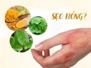 Làm đẹp - Sẹo bỏng có nặng đến mấy cũng hết nếu áp dụng mẹo sau!