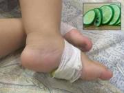 Làm mẹ - Mẹ Hà Nội mách mẹo dùng chanh cắt lát hạ sốt cho trẻ tức thì tại nhà