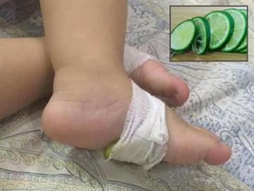 Mẹ Hà Nội mách mẹo dùng chanh cắt lát hạ sốt cho trẻ tức thì tại nhà