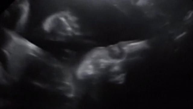 Khoảnh khắc em bé vẫy tay chào bố mẹ từ trong bụng siêu đáng yêu khiến dân mạng trầm trồ - 2