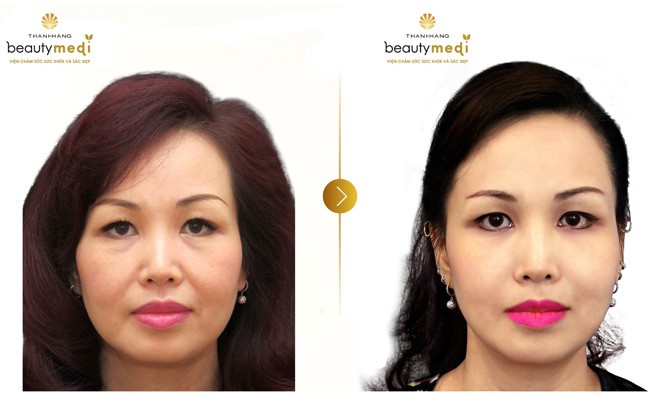 Hoa hậu Diệu Hoa: Đội vương miện hoa hậu là một áp lực… dễ chịu! - 5