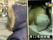 Tin tức - Nâng ngực hỏng hết nhũ hoa, cô gái tá hỏa khi biết sự thật sốc về bác sỹ phẫu thuật