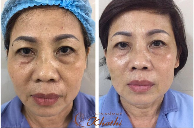 Tút tát diện mạo đón Tết với giá chỉ một nửa ngày thường - 5