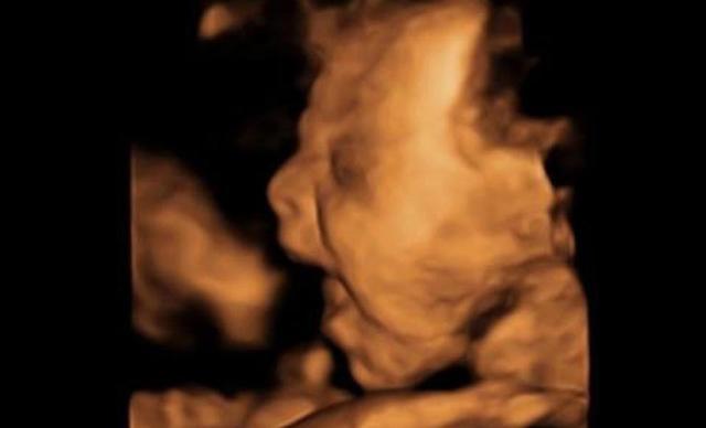 Khoảnh khắc em bé vẫy tay chào bố mẹ từ trong bụng siêu đáng yêu khiến dân mạng trầm trồ - 3