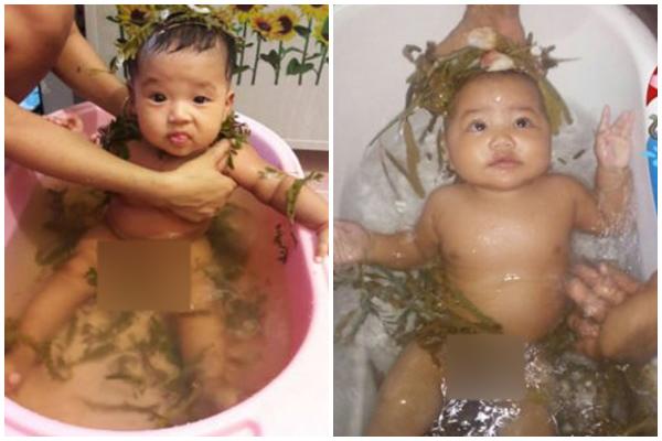 Bác sĩ nhi khoa mách mẹ cách chăm sóc trẻ bị mẩn ngứa mùa lạnh - 3