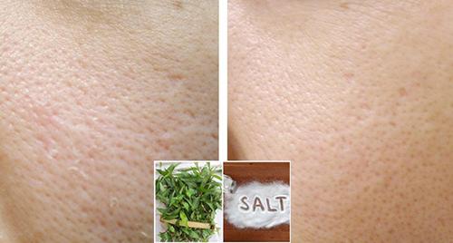 Mẹo se khít lỗ chân lông, hết nám với mớ rau răm 3 ngàn đồng - 5