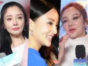 Làm đẹp - Chuyện ngoại tình chưa lắng, dân mạng soi đến gương mặt "lạm dụng" dao kéo của vợ Giả Nãi Lượng