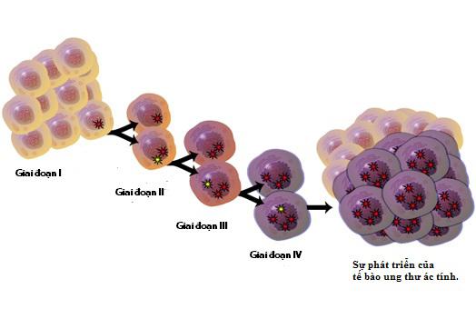 8 quan niệm sai lầm về bệnh ung thư cần từ bỏ ngay - 1