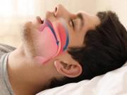 Sức khỏe - Hội chứng ngừng thở khi ngủ: Kẻ giết người thầm lặng