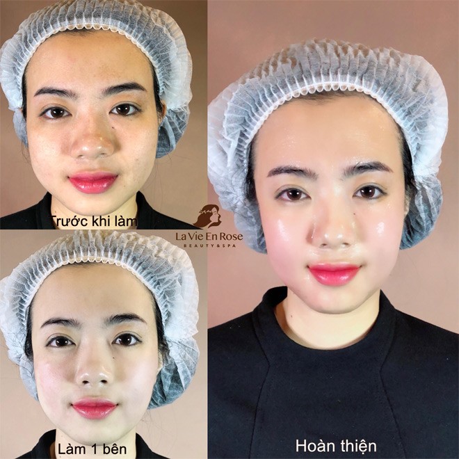amp;#34;Biến đổi Mỹ nhânamp;#34; - khi phép màu thành hiện thực - 1