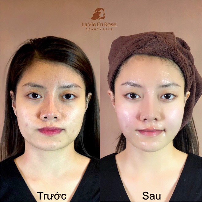 amp;#34;Biến đổi Mỹ nhânamp;#34; - khi phép màu thành hiện thực - 2