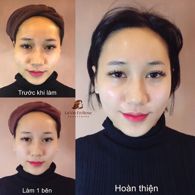 amp;#34;Biến đổi Mỹ nhânamp;#34; - khi phép màu thành hiện thực - 3