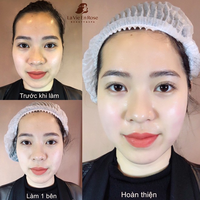 amp;#34;Biến đổi Mỹ nhânamp;#34; - khi phép màu thành hiện thực - 4