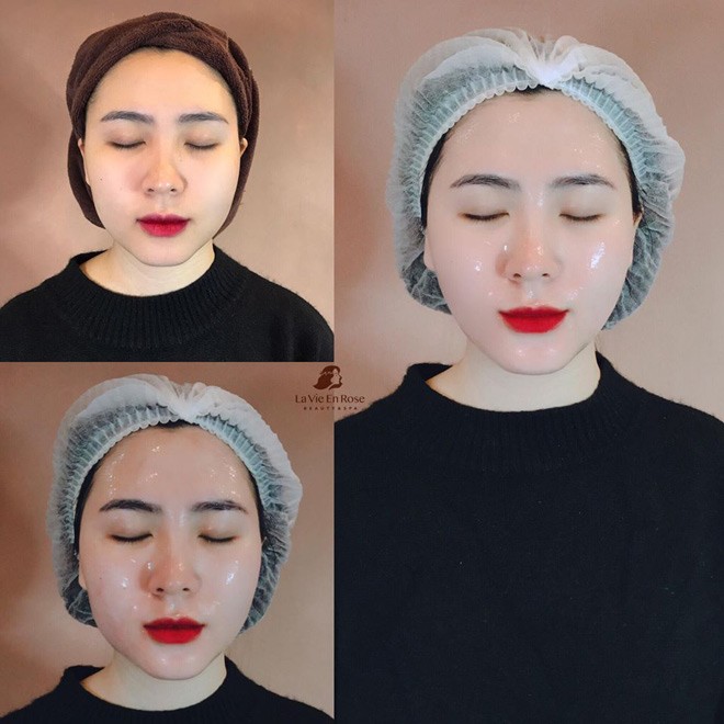amp;#34;Biến đổi Mỹ nhânamp;#34; - miễn phí cơ hội trẻ hoá da trị giá 23 triệu đồng - 2