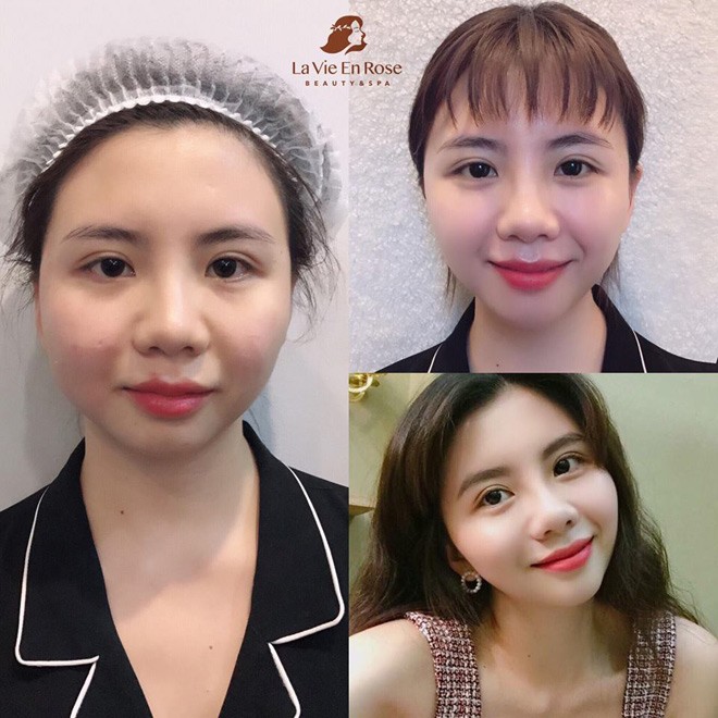 amp;#34;Biến đổi Mỹ nhânamp;#34; - miễn phí cơ hội trẻ hoá da trị giá 23 triệu đồng - 3