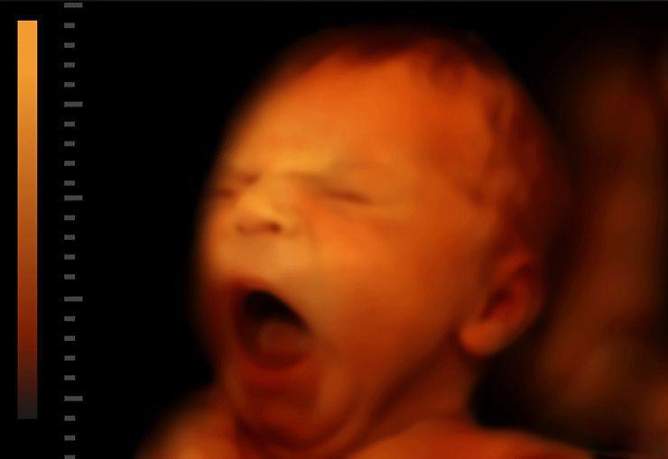 Không chỉ ngủ và đạp, em bé còn biết làm đủ trò thú vị trong bụng mẹ - 2