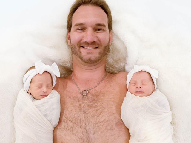 Cận cảnh gương mặt cặp song sinh của Nick Vujicic, xinh xắn, đáng yêu đến ngỡ ngàng