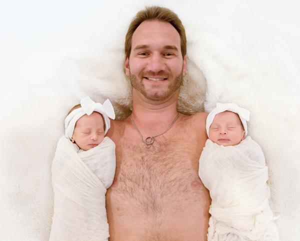 Cận cảnh gương mặt cặp song sinh của Nick Vujicic, xinh xắn, đáng yêu đến ngỡ ngàng - 2