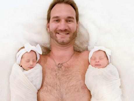 Cận cảnh gương mặt cặp song sinh của Nick Vujicic, xinh xắn, đáng yêu đến ngỡ ngàng