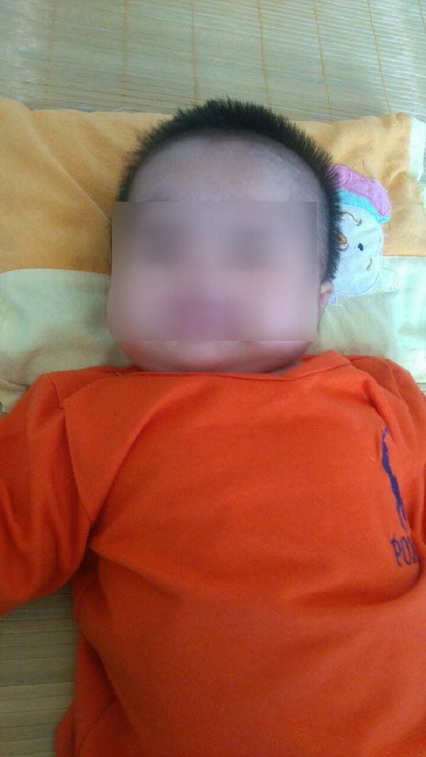 Hà Nội: Bé gái 8 tháng tuổi hôn mê nguy kịch nghi do tiêm nhầm thuốc - 4