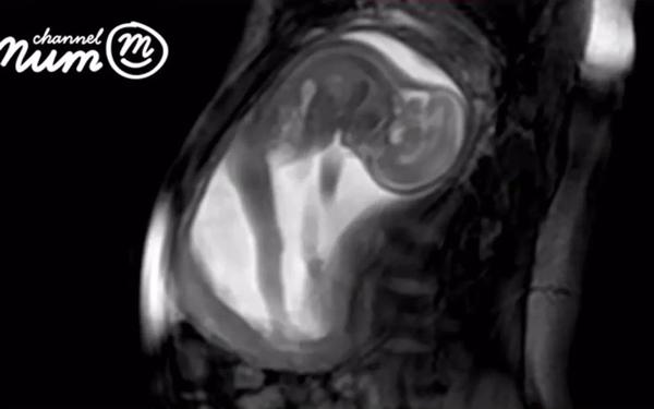 Công nghệ siêu âm rõ nhất thế giới giúp phát hiện những bất thường ở thai nhi - 2