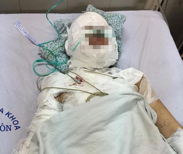 Mẹ cô gái bị người đàn ông ngoại quốc thiêu sống: amp;#34;Tôi không nhận ra con gái mình nữaamp;#34; - 1